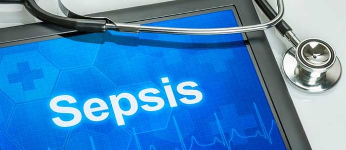 Sepsis